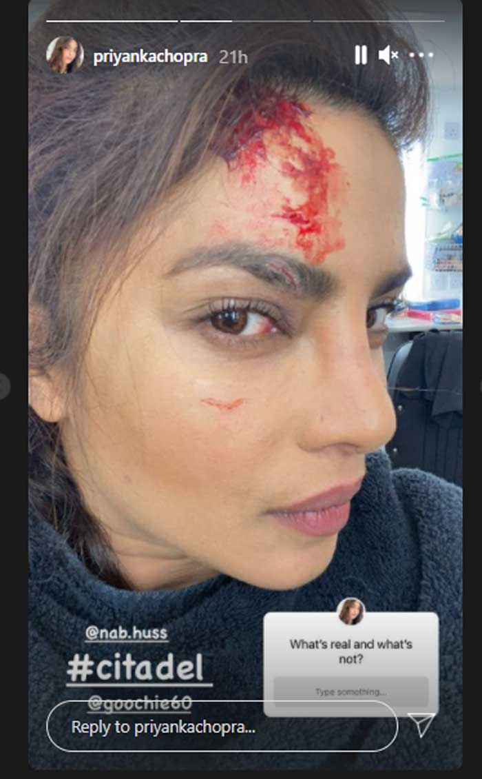 Priyanka Chopra sustains injury during shooting of ‘Citadel’