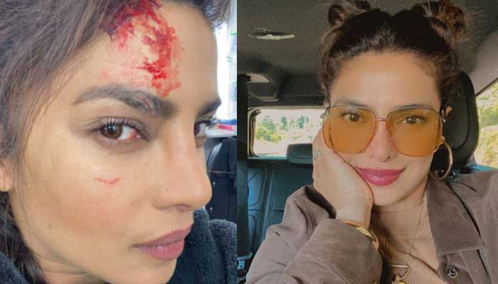 Priyanka Chopra sustains injury during shooting of ‘Citadel’