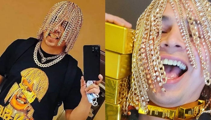 Meet The Mexican Rapper With Gold Chains Implanted In His Scalp