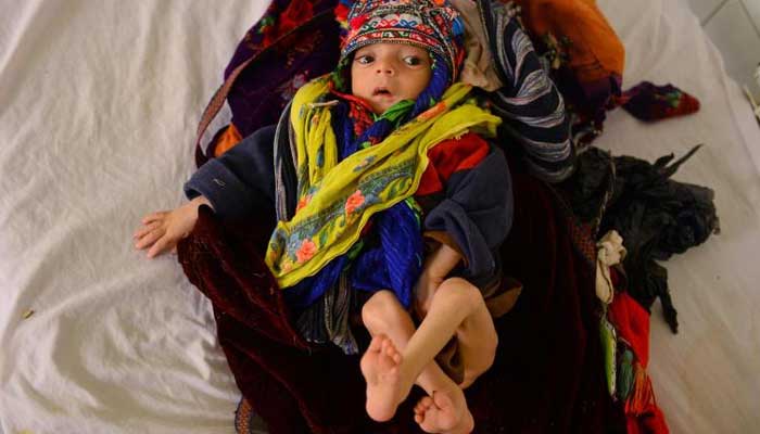 Omid, a ten-month-old malnourished child suffering from pneumonia is treated in Mofleh Pediatric Hospital in the province of Herat province, west of Afghanistan on January 29, 2019. — UNICEF/Hashimi/AFP
