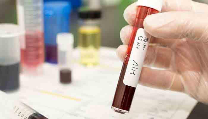 Rumah sakit umum Sindh mendiskriminasi orang dengan HIV dan AIDS