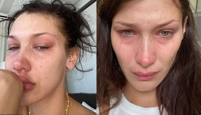 Bella Hadid mengungkapkan penderitaannya dengan selfie berlinang air mata