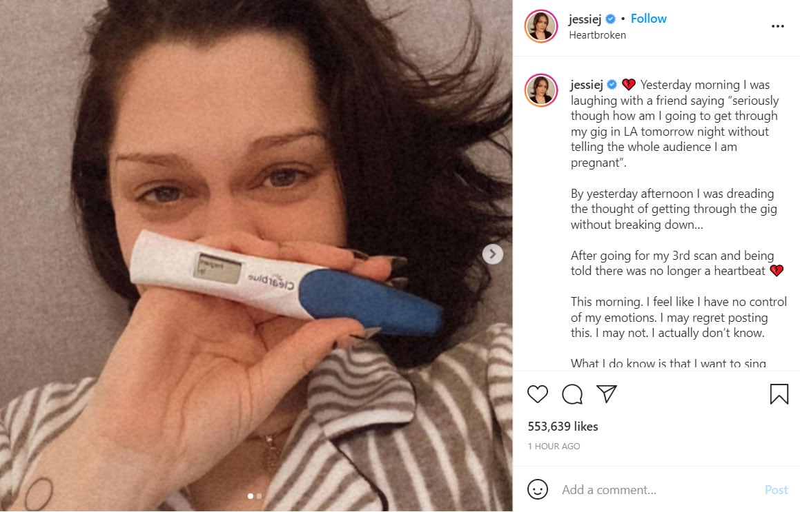 Jessie J weighs in on painful loss in miscarriage announcement: ‘I deserve that’