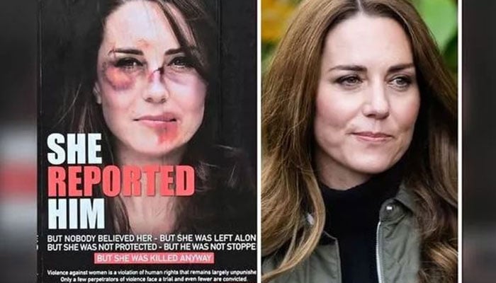Royal fans shocked after photo of bruised Kate Middleton surfaces online