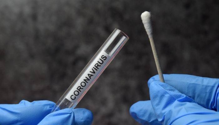 Coronavirus test kit - Stock photos
