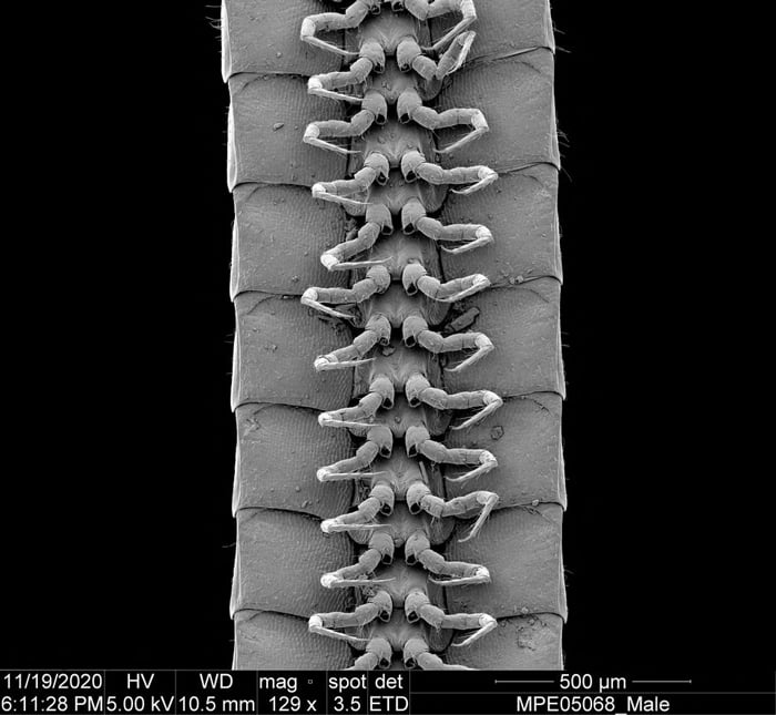 A microscope view of the legs of a male individual of the newly identified millipede species Eumillipes persephone discovered deep underground in Australia is seen in this undated photograph. — Reuters