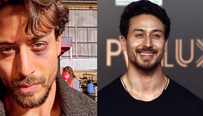 Tiger Shroff drops picture of his eye injury amid ‘Ganapath: Part 1’ shoot