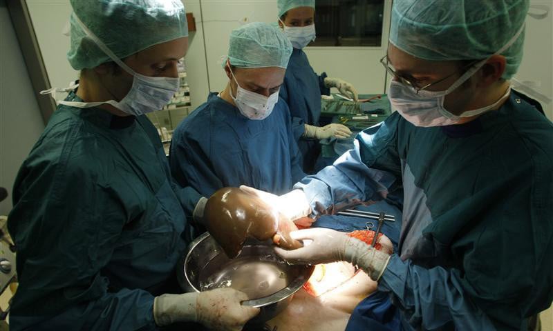 When will KP start free liver transplants under the Sehat card? - Vimarsana News