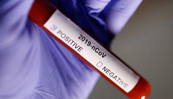 Test tube with Coronavirus label is seen in this illustration taken on January 29, 2020. — Reuters/File