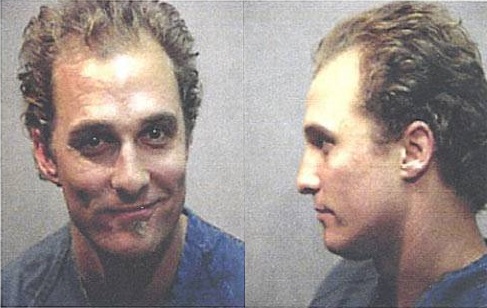 Matthew McConaughey on his infamous hair transplant, says ‘doctor lied about it’