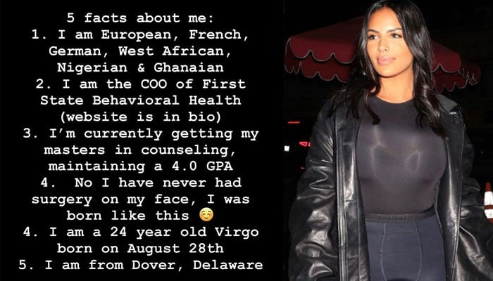 Kanye West’s new muse Chaney Jones shuts surgery rumours: ‘born like this’