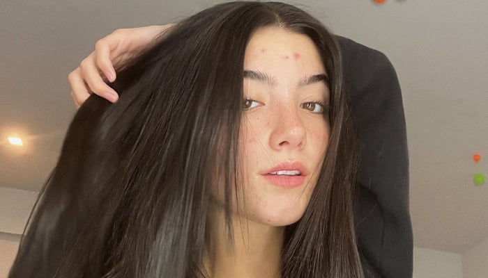 TikTok sensation Charli D’Amelio recently made headlines after deciding to ditch the filters