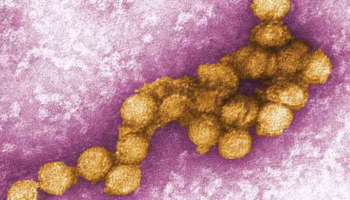 Colourized transmission electron micrograph (TEM) of West Nile virus.-Courtesy Britanica