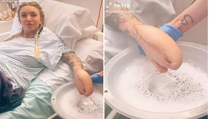 Sadie Kemp fights sepsis. —Screenshots from TikTok video/sadiessepsisjourney