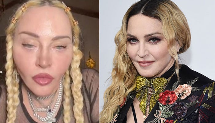 Madonna sparks concern with unsettling pre-Grammys video