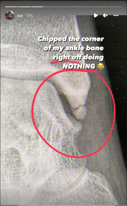 SZA shares how she got her ankle injured right before Grammys