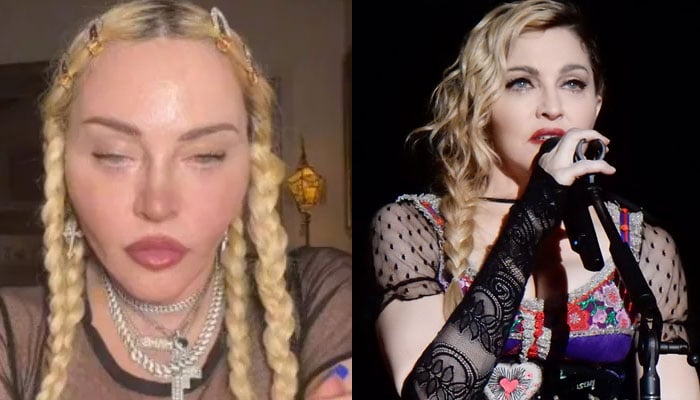 Plastic surgeon points out lots of issues on Madonnas face post bizarre video