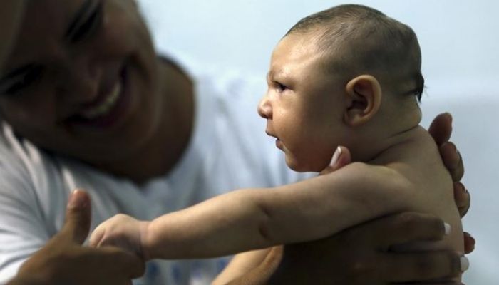 Therapist Rozely Fontoura holds Juan Pedro, who has microcephaly, in Recife, Brazil March 26, 2016. Reuters