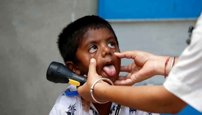 A healthcare worker examines a child during door-to-door surveillance to safeguard children amidst the spread of the coronavirus disease (COVID-19), at a village on the outskirts of Ahmedabad, India, June 9, 2021. — Reuters