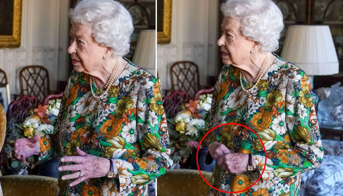 Queen and her purple hands: A health concern overlooked by royals?