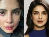  Priyanka Chopra shares a picture of her bruised face: ‘Tough day at work’