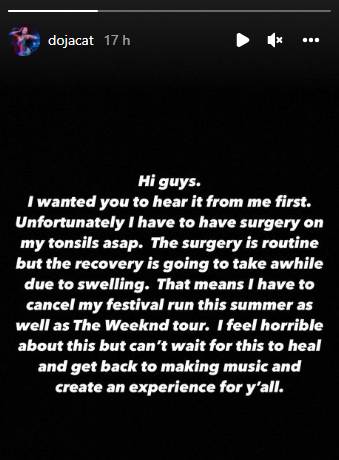 Doja Cat reveals she is taking a hiatus from singing due to tonsil surgery