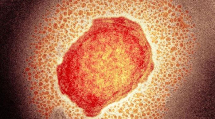 Pakistan's top health body issues monkeypox alert