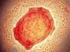 Pakistan's top health body issues monkeypox alert