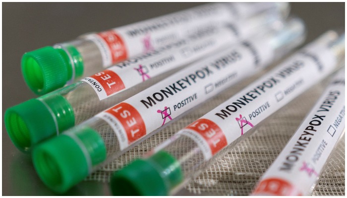 Test tubes labelled Monkeypox virus positive are seen in this illustration taken May 22, 2022. — Reuters