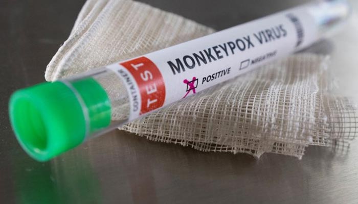 The picture shows a test tube labelled monkeypox virus. — Reuters