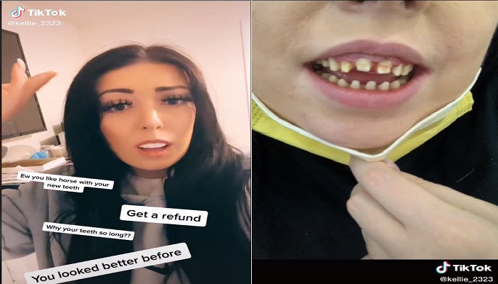 Kellies teeth treatment. —Tiktok/@kellie_2323