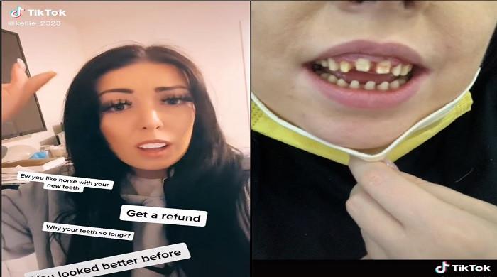 Watch: Woman gets trolled for her new 'horse teeth'