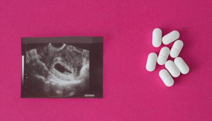 Representational image for abortions. — Canva/file