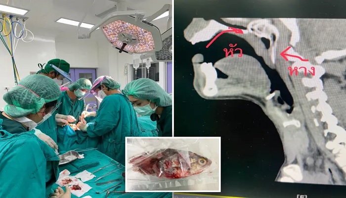 Ikan melompat ke mulut manusia, menggoyangkan tenggorokannya