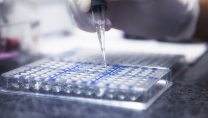Rapid test for HIV in laboratory — Canva/file