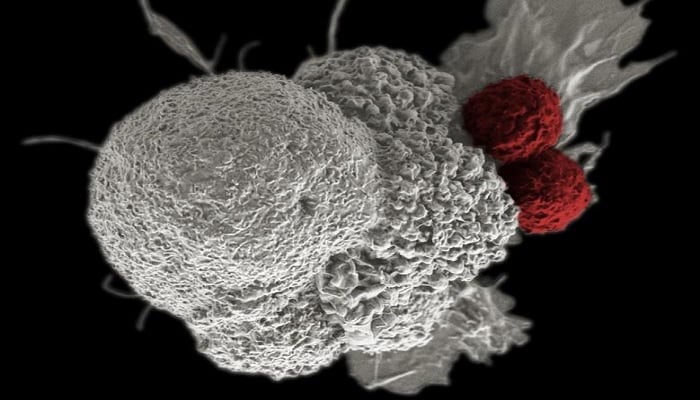 An oral squamous cancer cell (white) being attacked by two cytotoxic T cells (red), part of a natural immune response.—Reuters
