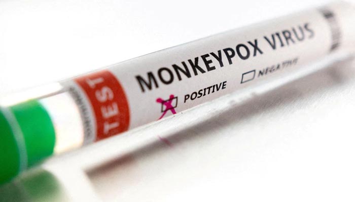 Test tube labelled Monkeypox virus positive is seen in this illustration taken May 22, 2022. — Reuters/File