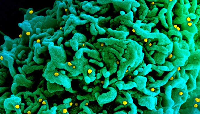 A cell infected with particles (yellow; artificially coloured) of the SARS-CoV-2 variant called B.1.1.7, which is more easily transmitted than other versions of the virus.—National Institutes of Health