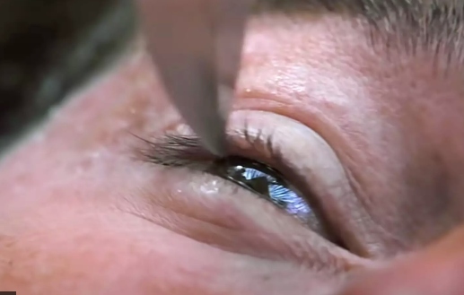 Tom Cruises Knife to the eye in Mission: Impossible 11