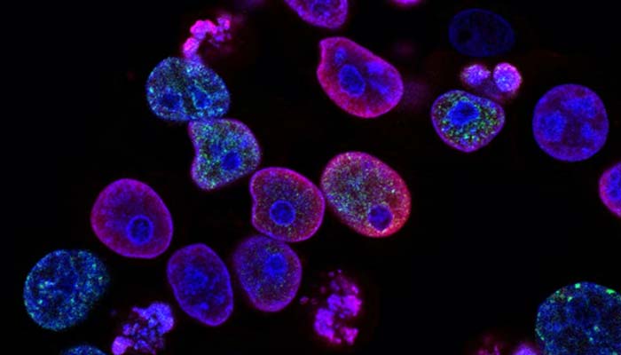 Human colorectal cancer cells treated with a topoisomerase inhibitor and an inhibitor of the protein kinase ATR (ataxia telangiectasia and Rad3 related).— Unsplash