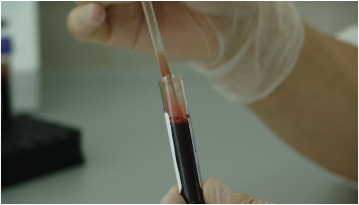 Representational image of a person holding a test tube filled with blood. — Pixabay/ PublicDomainPictures