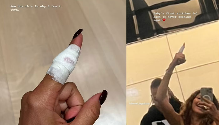 Zendaya vows to never cook again after getting index finger stitched up