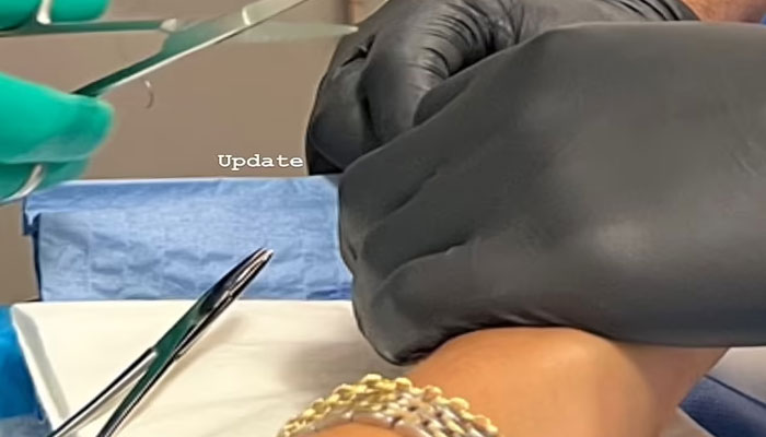 Zendaya vows to never cook again after getting index finger stitched up