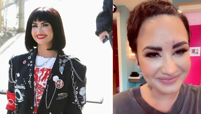 Demi Lovato reveals how they get wounded by a ‘crystal’