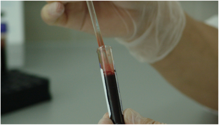 Person holding a test tube filled with blood. — Pixabay/PublicDomainPictures