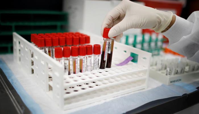 A health worker takes test tubes with plasma and blood samples after a separation process in a centrifuge during a coronavirus disease (COVID-19) vaccination study at the Research Centers of America, in Hollywood, Florida, US, September 24, 2020. — Reuters/File