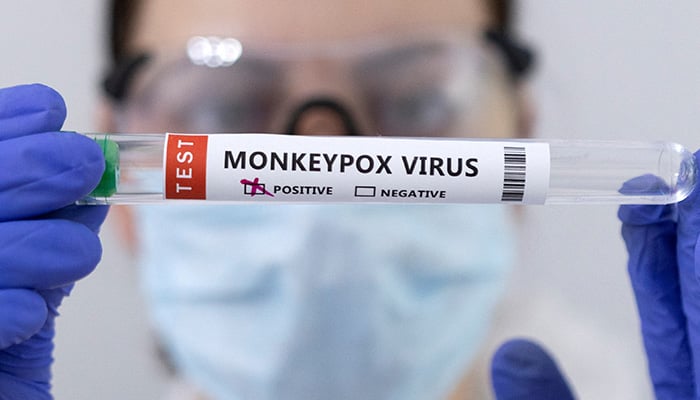 Test tubes labelled Monkeypox virus positive are seen in this illustration taken May 23, 2022. — Reuters