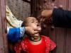 Pakistan detects fresh polio case in North Waziristan 