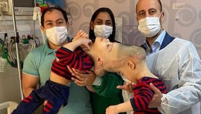 Surgeon Noor ul Owase Jeelani with Bernardo (left) and Arthur, and parents.— Gemini Untwined