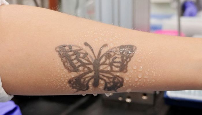 Water sprays on arm are seen with an electronic tattoo (e-tattoo) for the wettability test at the Korea Advanced Institute of Science and Technology (KAIST) in Daejeon, South Korea, July 26, 2022. —Reuters